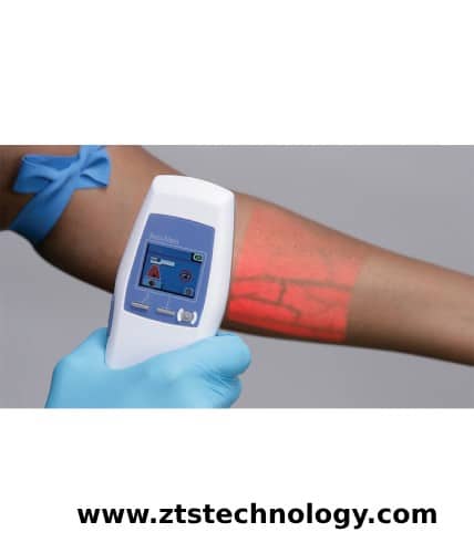 تشخیص کلسترول خون با رگیاب