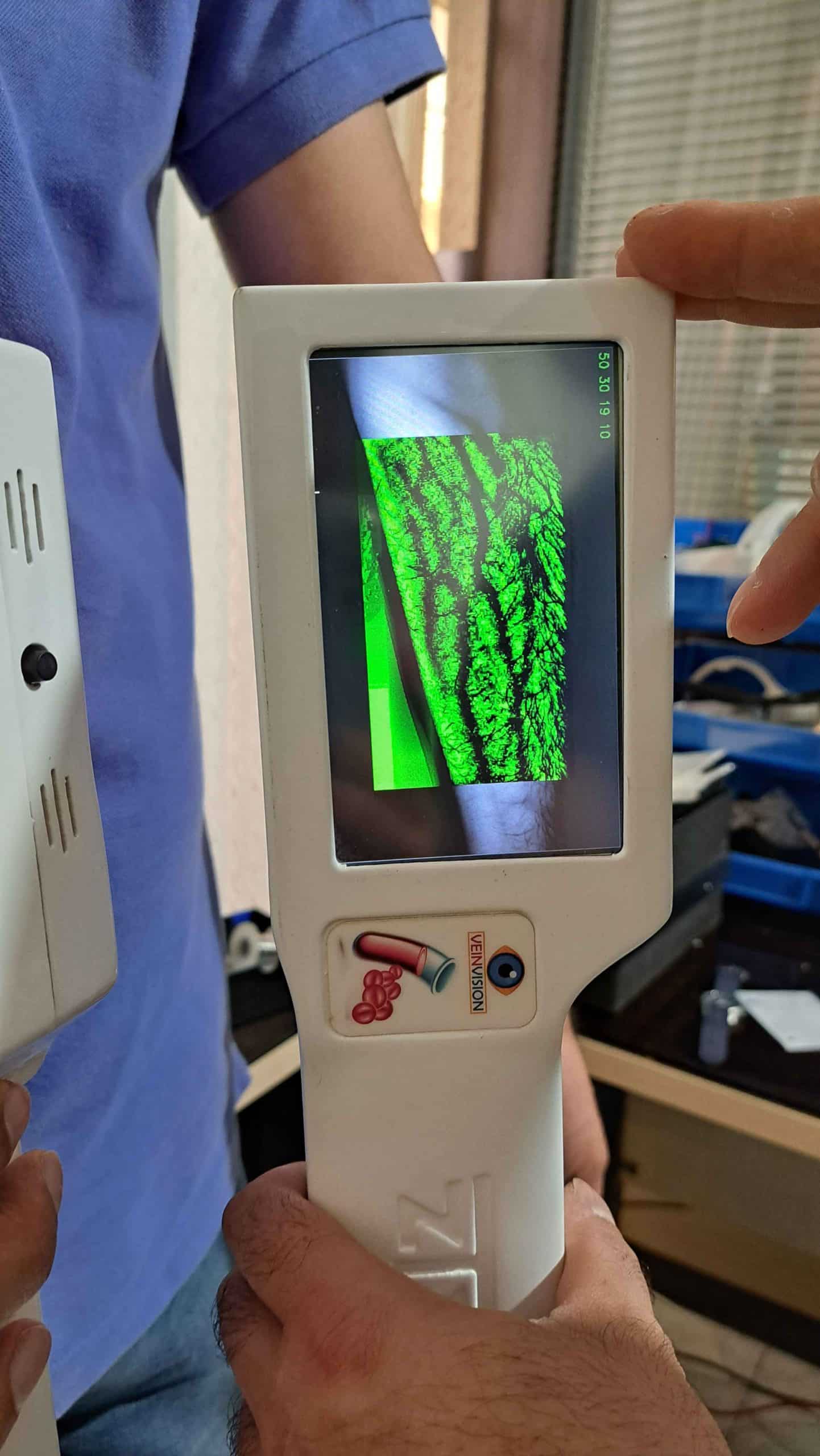 رگ یاب نوزاد