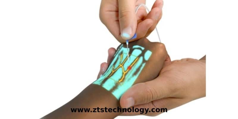 دستگاه رگ یاب دست دوم