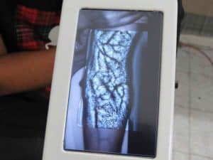 دستگاه رگ یاب