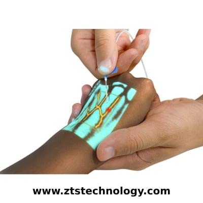 رگ یاب لیزری