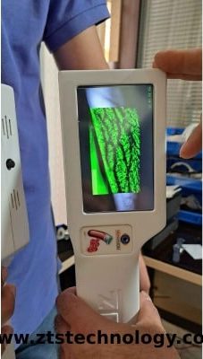 رگ یاب لیزری